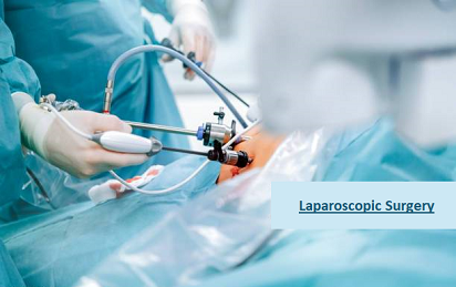 Laparoscopic surgery