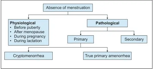 Types of Amenorrhea