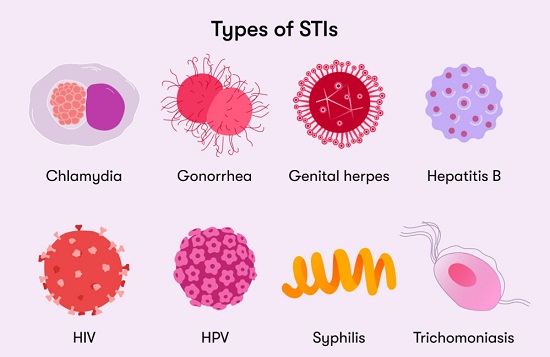 Types of Sexually Transmitted Diseases