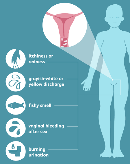 Symptoms of Vaginitis